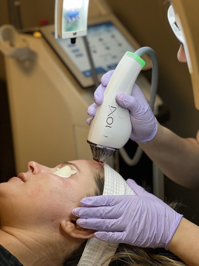 A patient being treated with MOXI laser skin resurfacing.