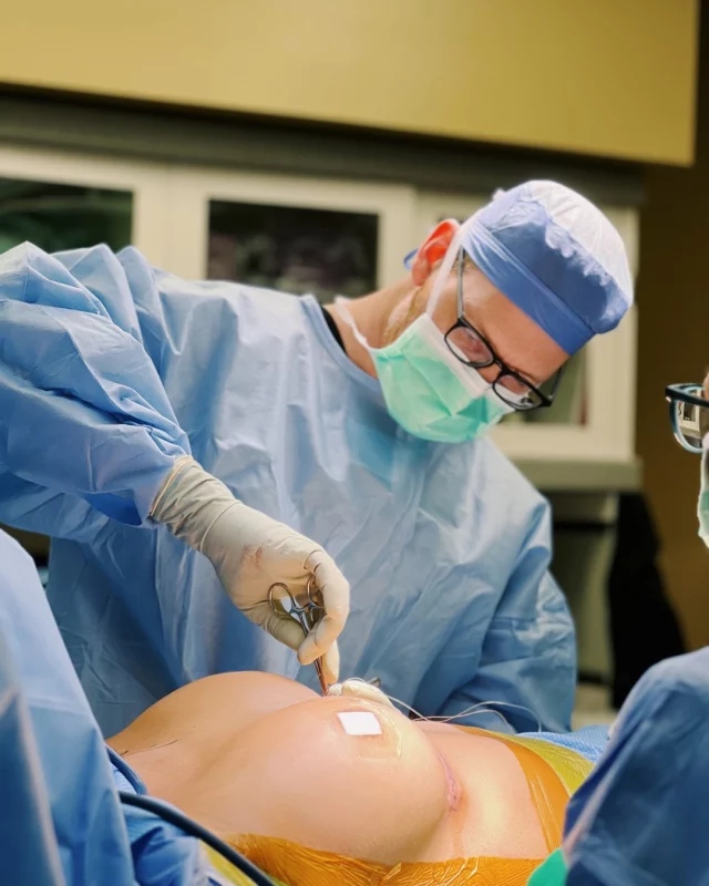 📸: Dr. Michael Carlisle performing a breast augmentation procedure at West Lakes Surgery Center in Des Moines.

During your in-person consultation with Dr. Carlisle, you will be “sized” using a Volume Sizing System that creates a more realistic preview of your new size on YOUR body. 

A series of soft, sterilized silicone inserts will be placed over your breasts inside a sports bra until your desired proportions are achieved. It is important to see how the new size looks on YOUR body when choosing an implant size. 

This system has been shown to increase the likelihood of size satisfaction over computer-generated images, which can be confusing.

While there are many options for implants, the most commonly used implant is a smooth round silicone implant because of its natural feel and safety record. 

Dr. Carlisle will help you decide which implant is best based on your body type, concerns, and goals.

Interested in learning more? We encourage you to schedule a cosmetic consultation with Dr. Carlisle at Koch & Carlisle Plastic Surgery & Spa: 515-277-5555
➡ Inquire online: https://www.kochandcarlisle.com/contact-us/